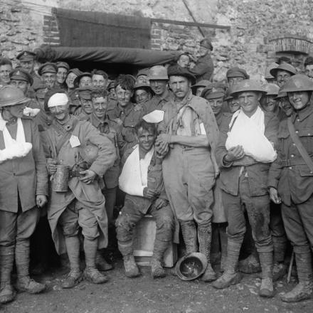 Britannici, francesi e italiani feriti in una stazione di medicazione nel Bois de Reims durante la Battaglia dei Tardenois, il 24 luglio 1918. © IWM (Q 11114)